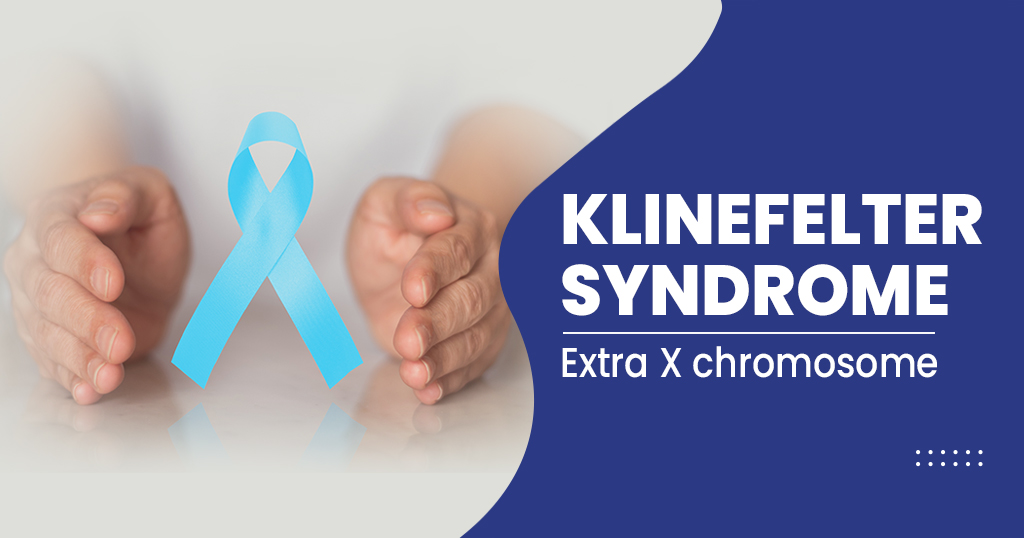 What is Klinefelter syndrome? - Causes, Symptoms and more