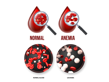 leukemia and anemia illustrations