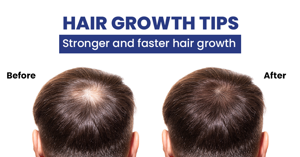 HAIR GROWTH TIPS