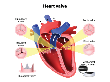 Types of Heart halves