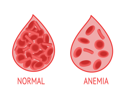 Anaemic red blood cells 