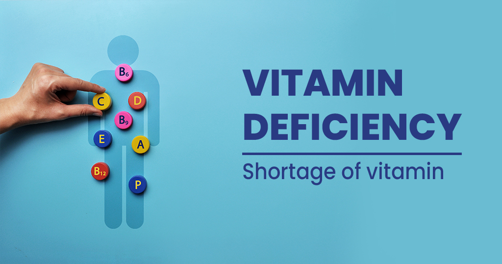 Vitamin deficiency and hair loss