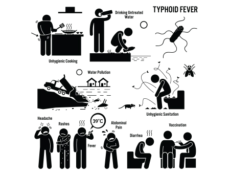 Symptoms of Typhoid