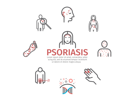 Symptoms of Pustular Psoriasis