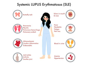 Symptoms of Lupus 