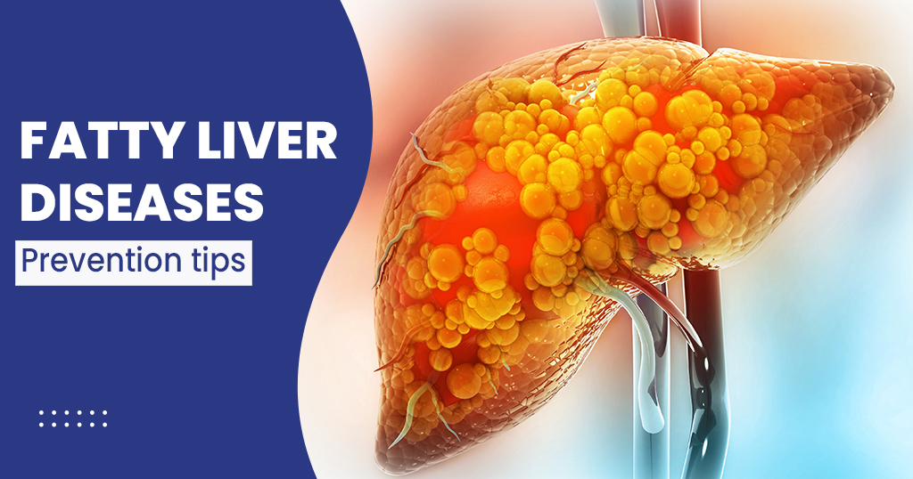 FATTY LIVER DISEASES
