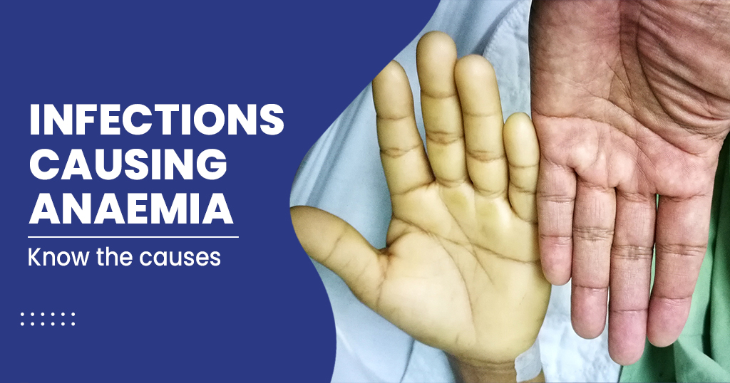 INFECTIONS CAUSING ANAEMIA