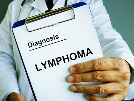Diagnosing Non-Hodgkin's lymphoma 