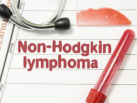 Non-hodgkin lymphoma