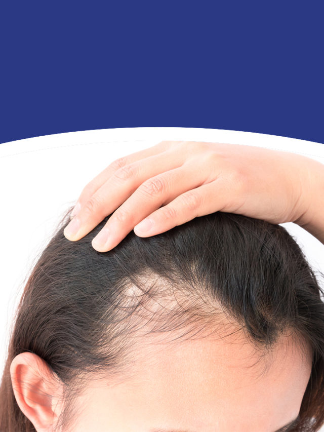 6 Home remedies to prevent hair loss