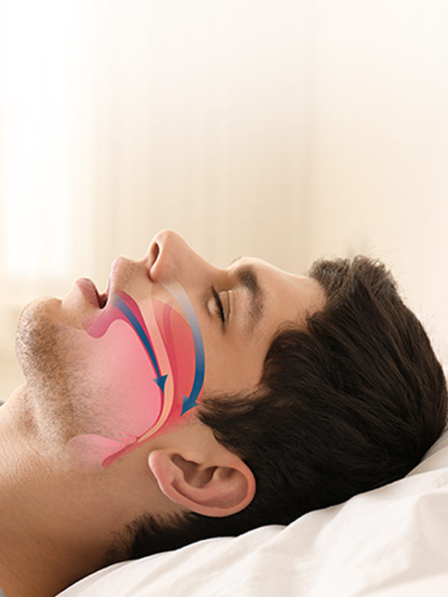 4 Home Remedies to  Stop Snoring
