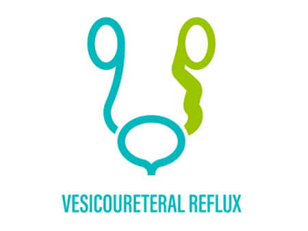 Vesicourreteral reflux