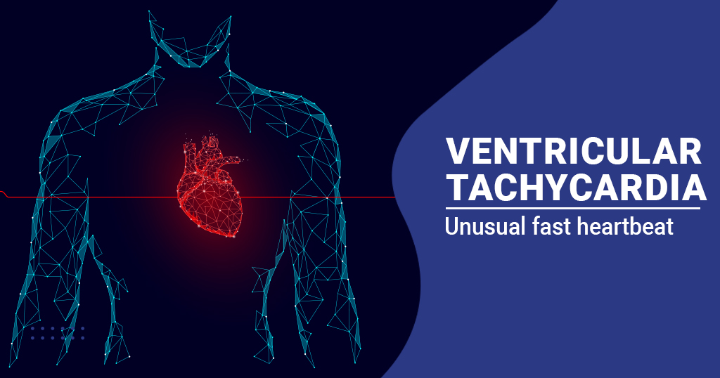Ventricular tachycardia
