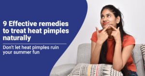 9 Effective remedies to treat heat pimples naturally