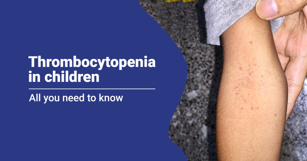 Thrombocytopenia in Children